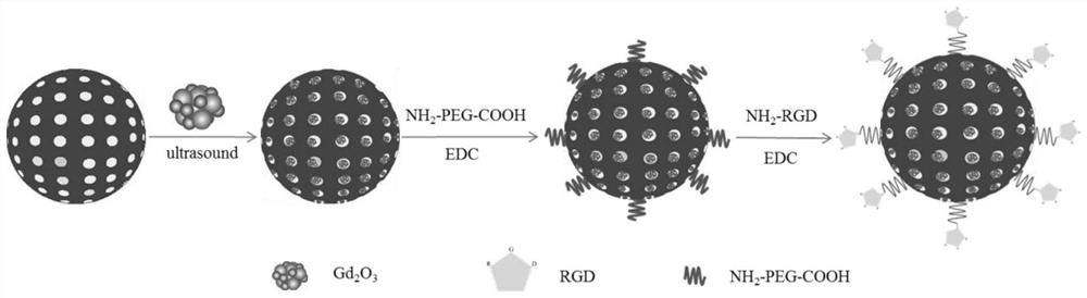 A kind of MRI contrast agent and its preparation method and application