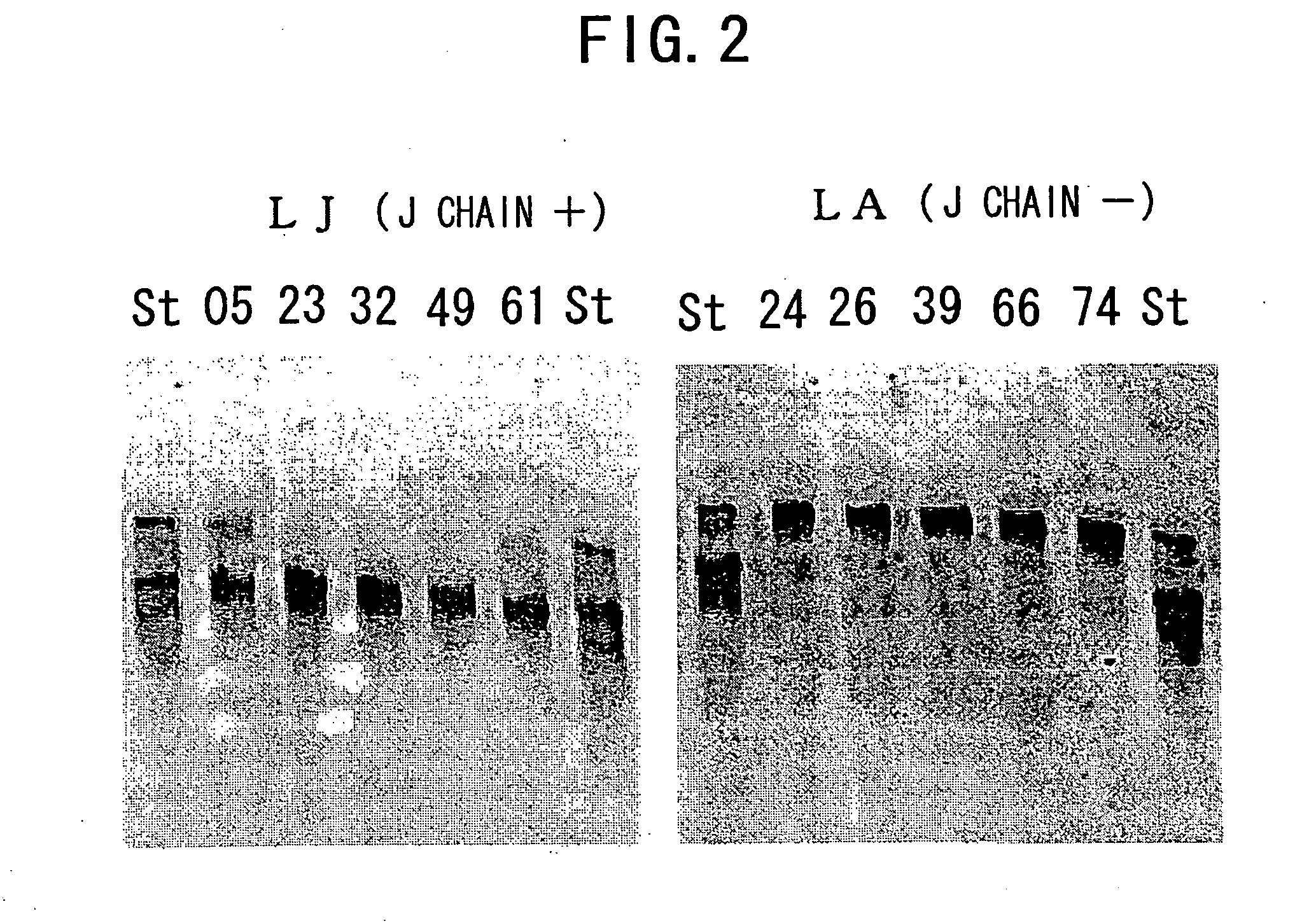 IGM production by transformed cells and methods of quantifying said IgM production