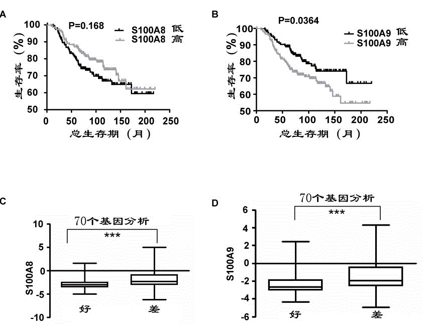 Method for taking molecular marker in diagnosis and prognosis evaluation of breast cancer