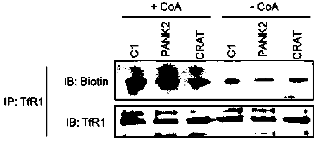 Methods and pharmaceutical compositions for the treatment of neurodegeneration with brain iron accumulation