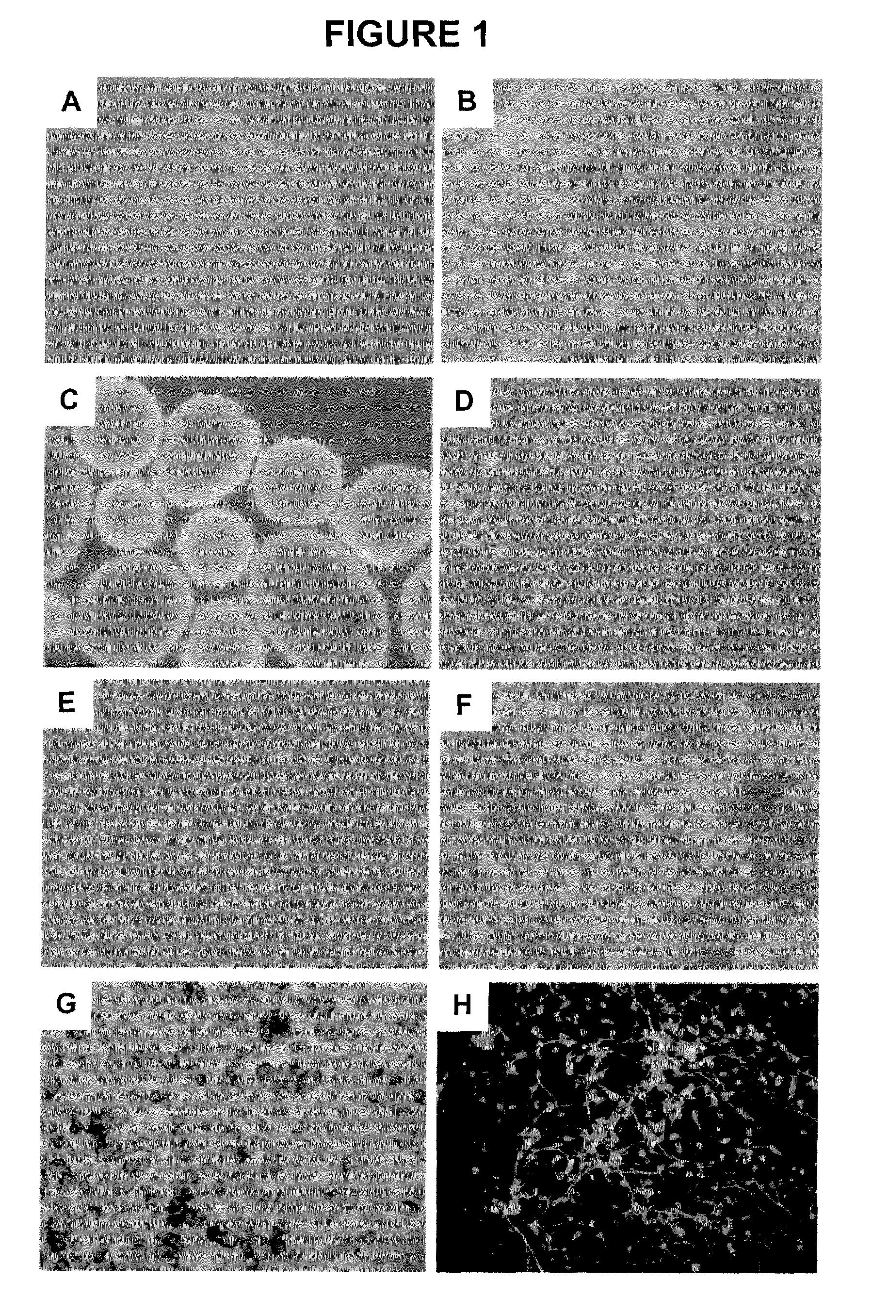 Methods of derivation of neuronal progenitor cells from embryonic stem cells