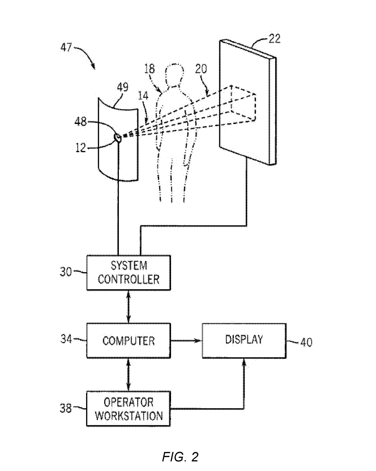 Digital breast Tomosynthesis reconstruction using adaptive voxel grid