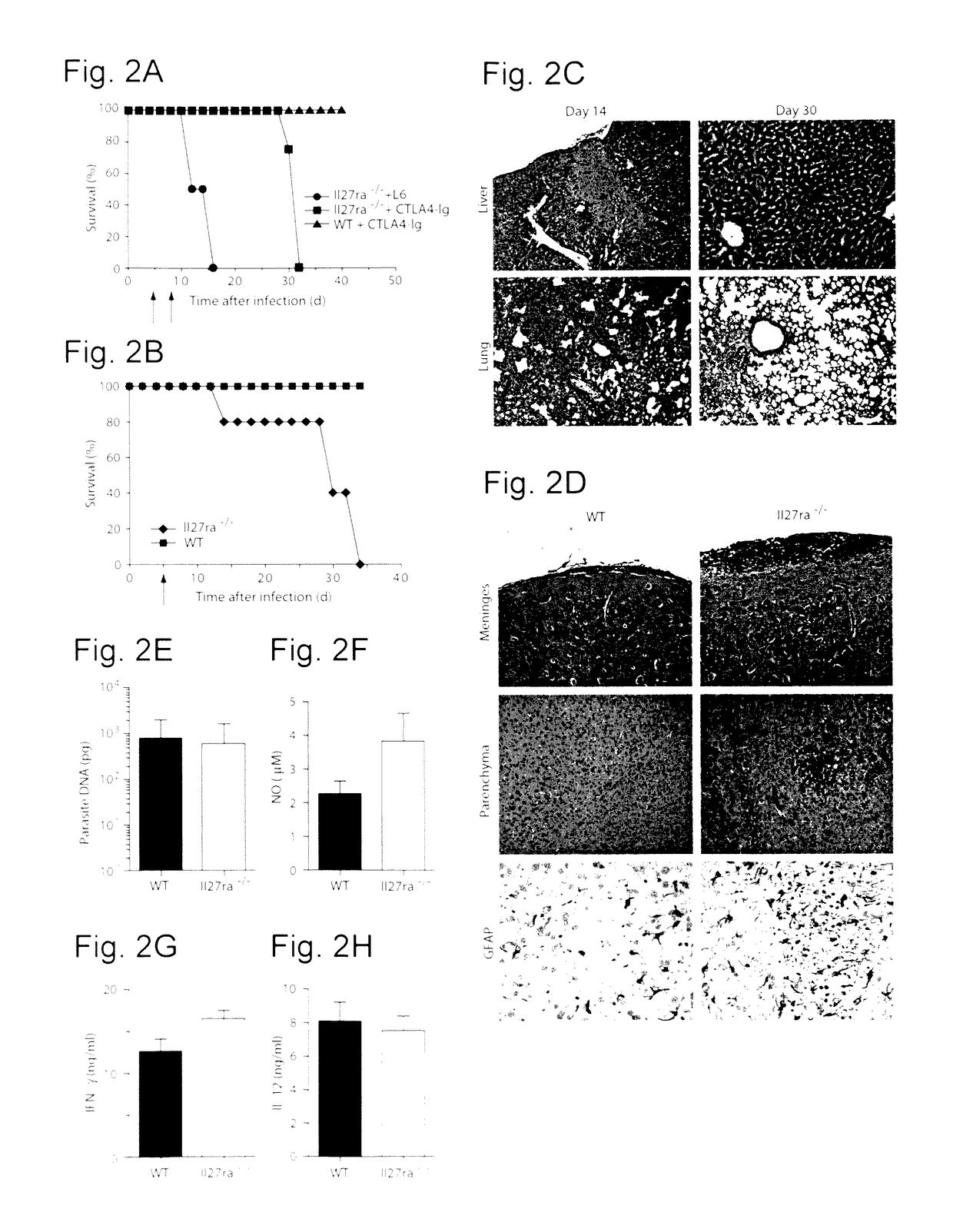 WSX-1/P28 as a target for anti-inflammatory responses