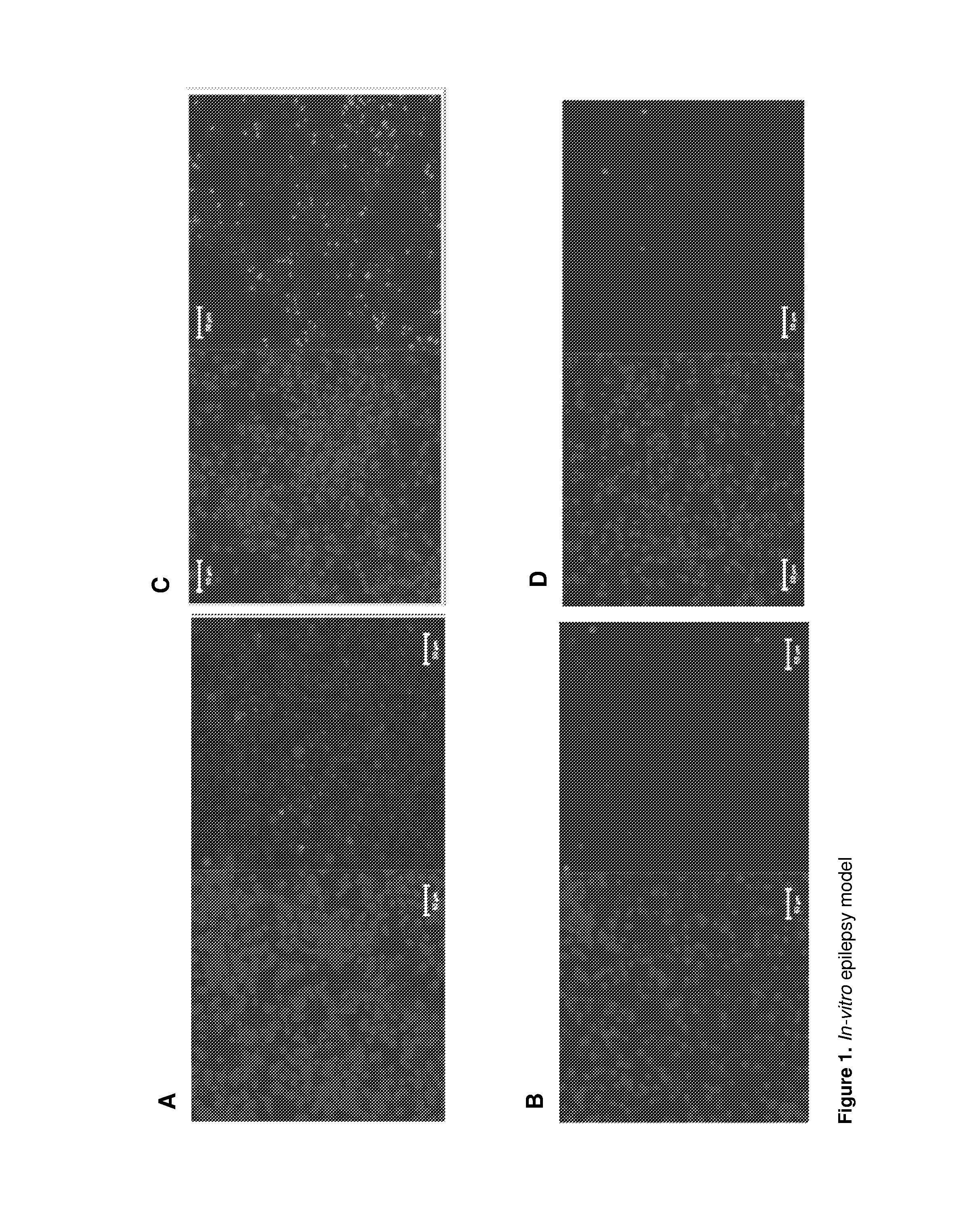 Reduction of epileptic seizures