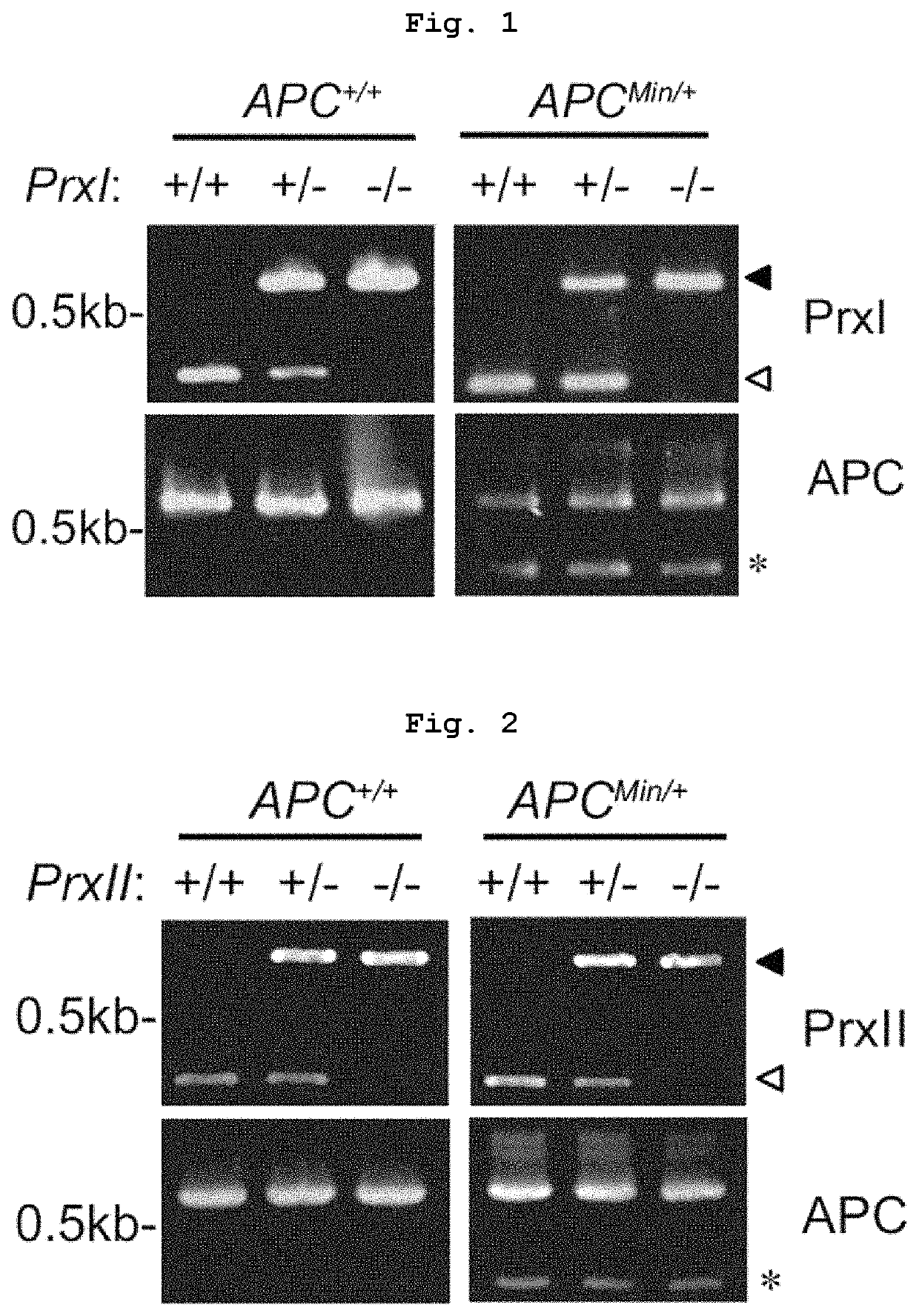 Pharmaceutical composition comprising substance inhibiting enzymatic activity of peroxiredoxin 2 as effective ingredient for treatment of colorectal cancer