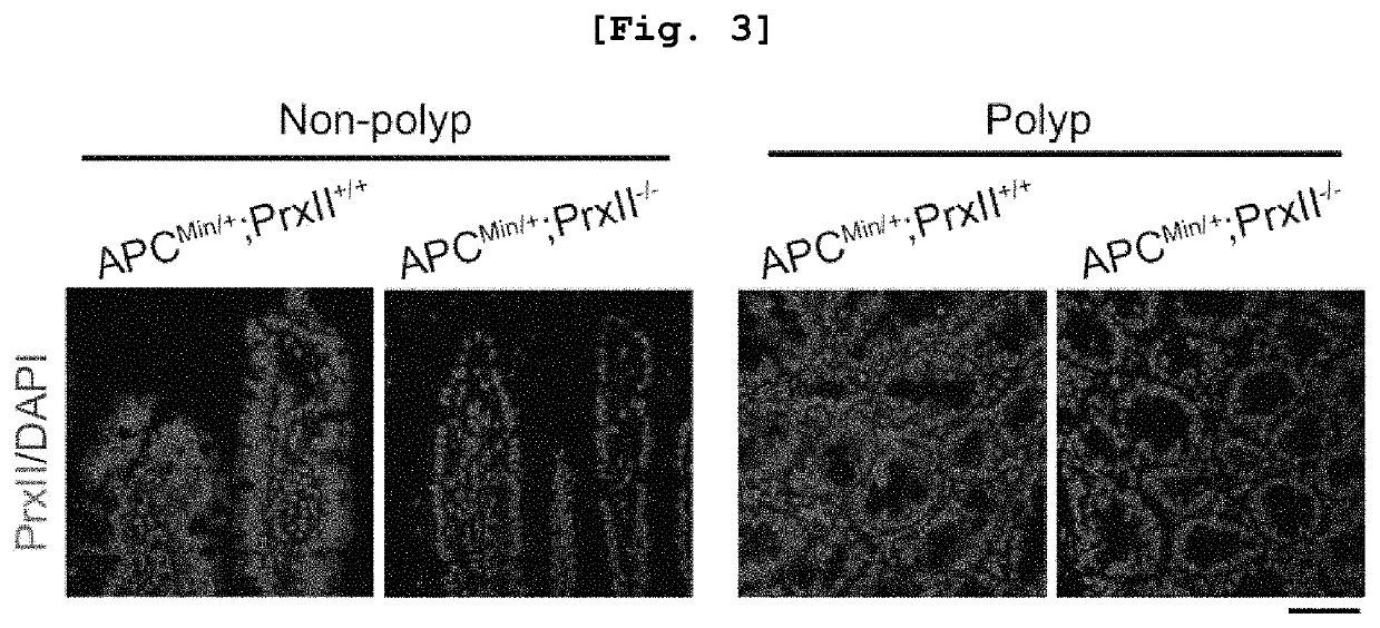 Pharmaceutical composition comprising substance inhibiting enzymatic activity of peroxiredoxin 2 as effective ingredient for treatment of colorectal cancer