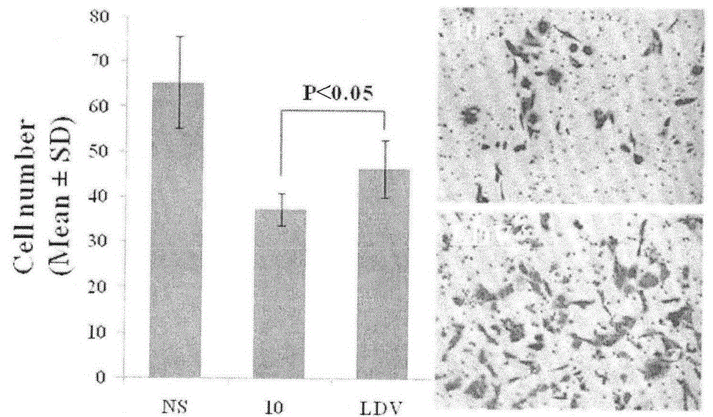 Leu-Asp-Val modified curcumin, preparation method, biological activity and application thereof