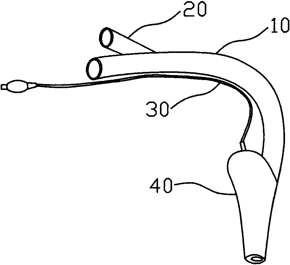 Laryngeal mask for esophageal blockage