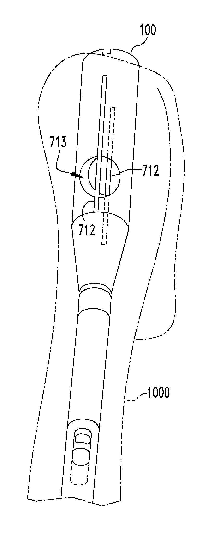 Composite internal fixators