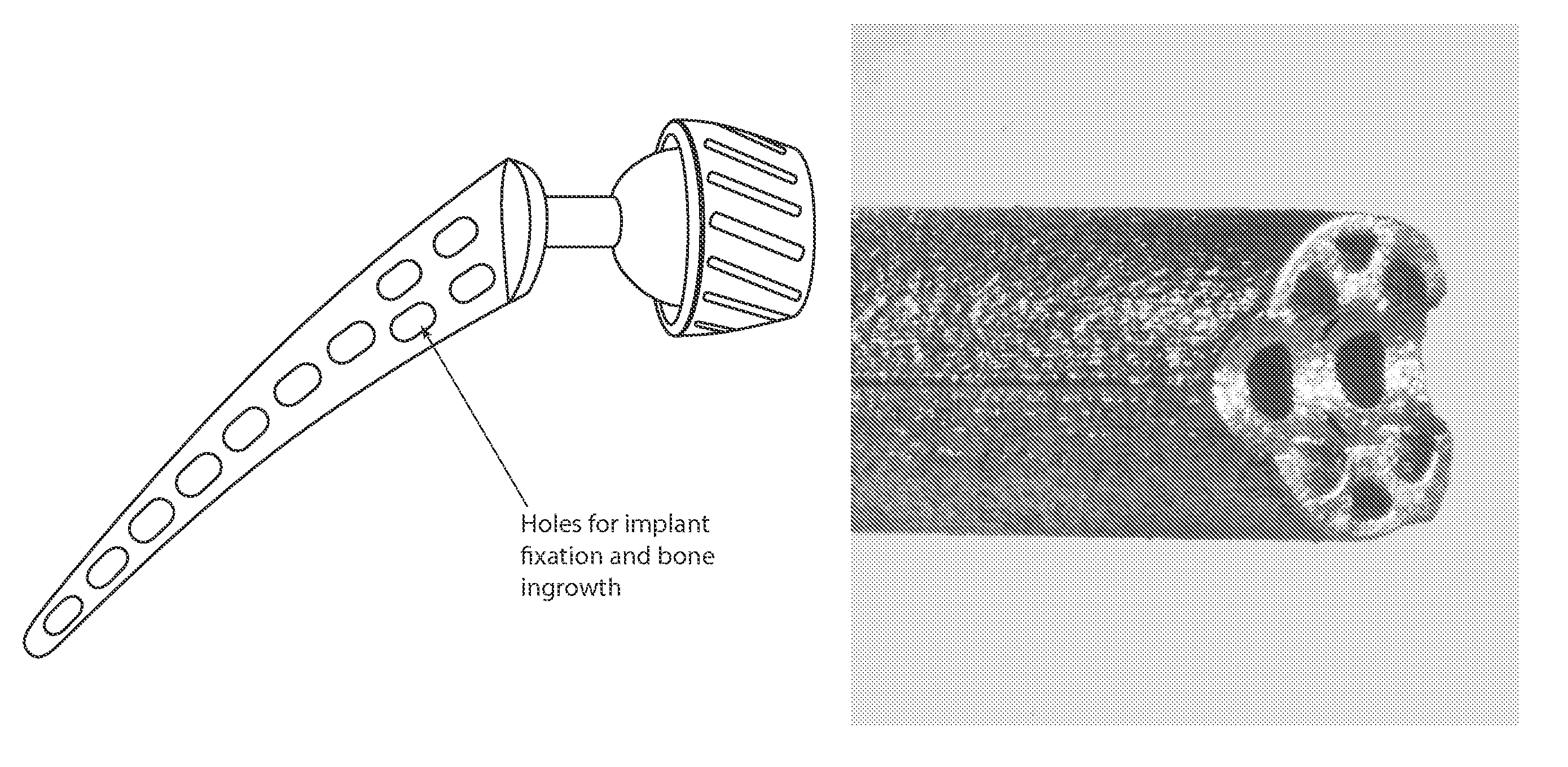 Orthopaedic implants and methods of forming implant structures