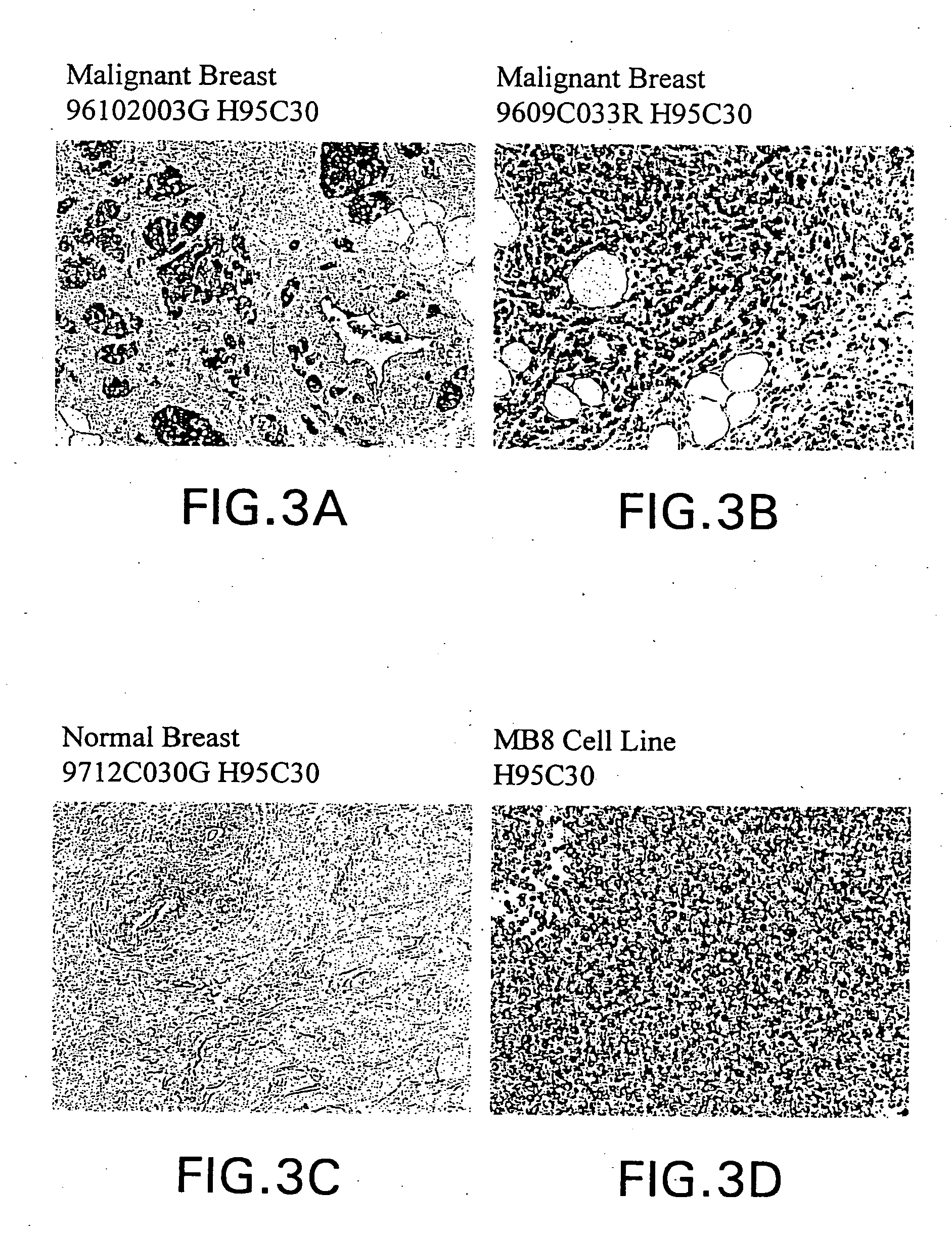 Reagents and methods useful for detecting diseases of the breast