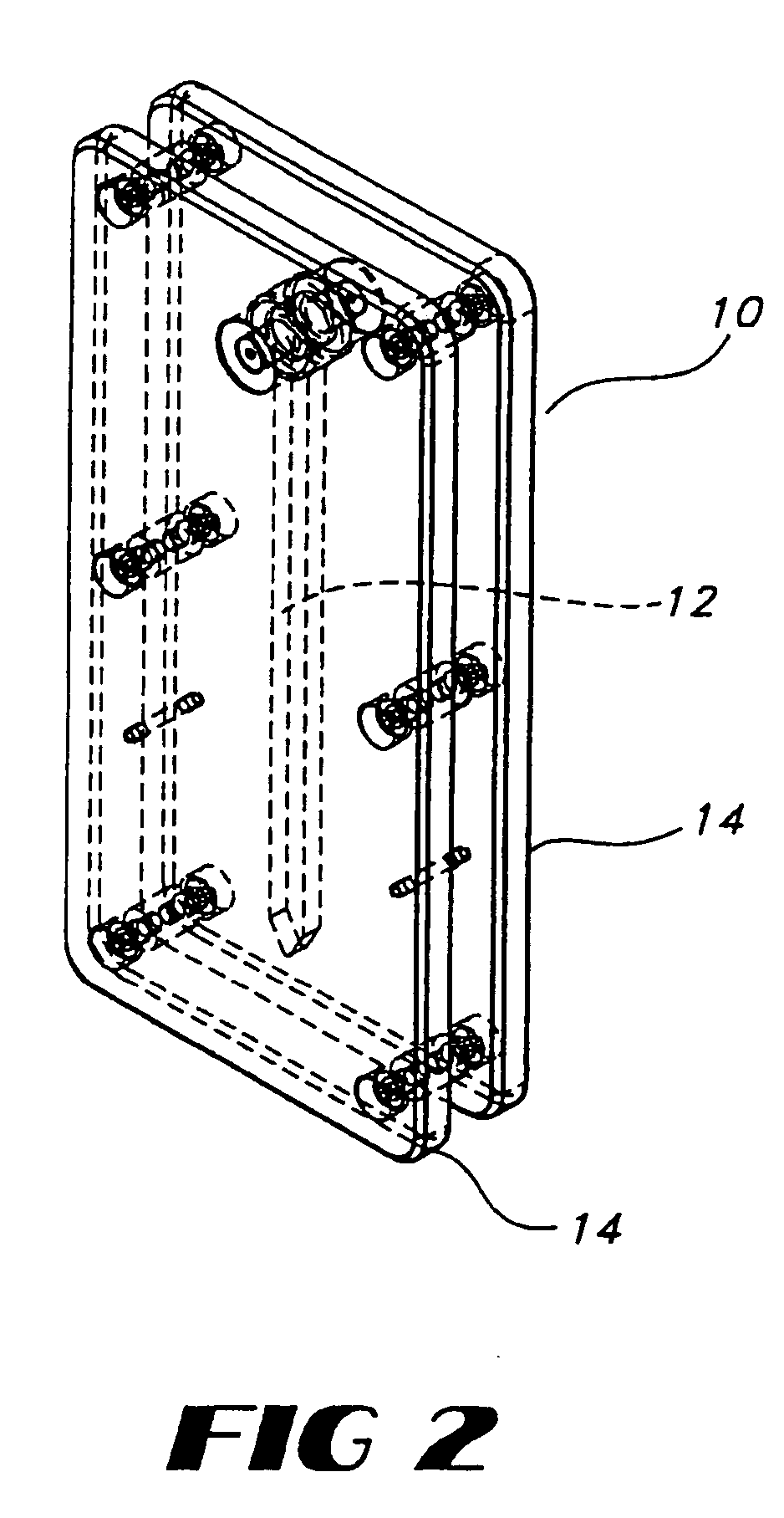 Method and apparatus for stereotactic implantation