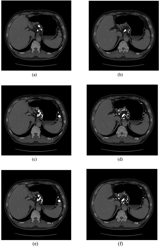 Lymph gland detection system and method based on stomach computed tomography (CT) image with shape fitting with oval