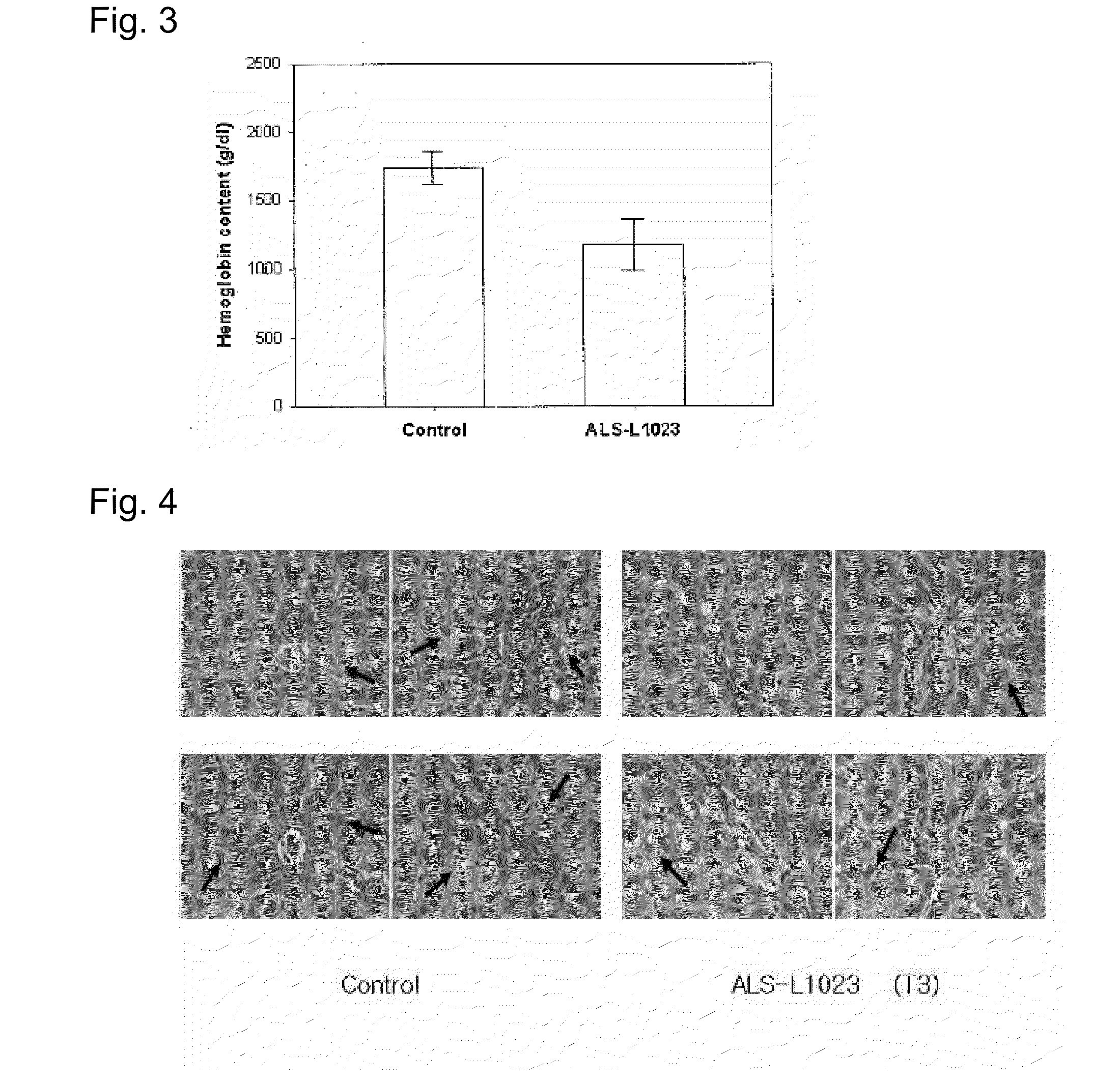 Fraction of melissa leaf extract having angiogenesis and mmp inhibitory activities, and composition comprising the same