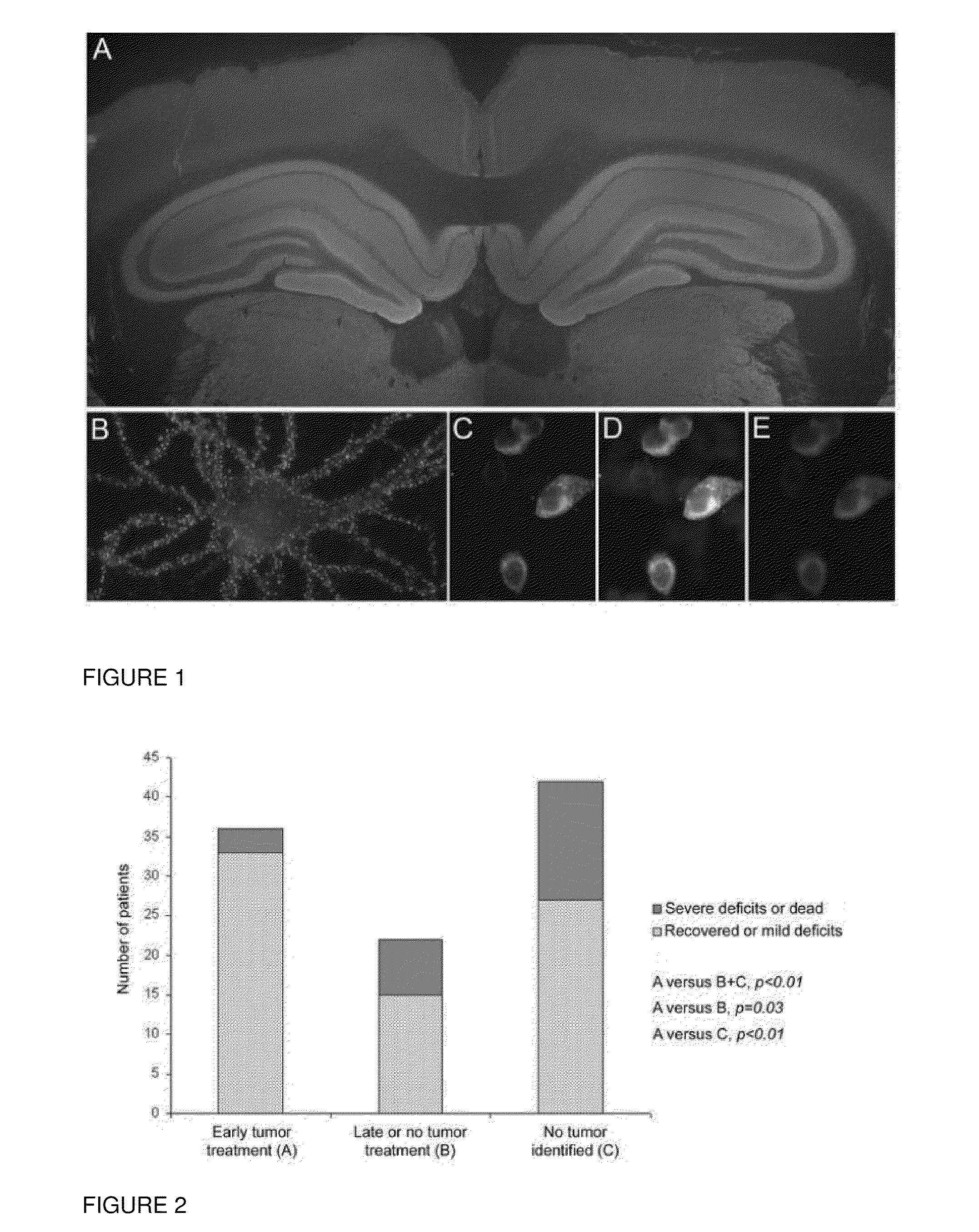 Methods and compositions for treatment and diagnosis of encephalitis or epilepsy
