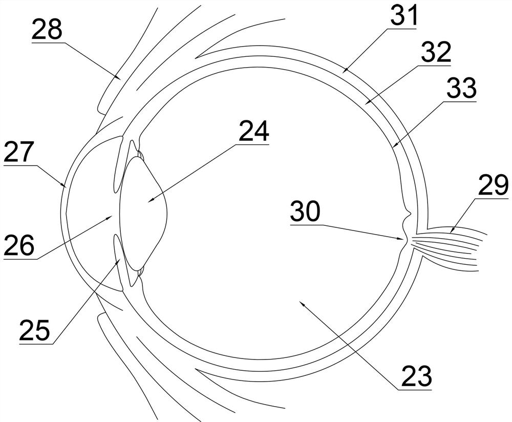 A microneedle device for retinal veins