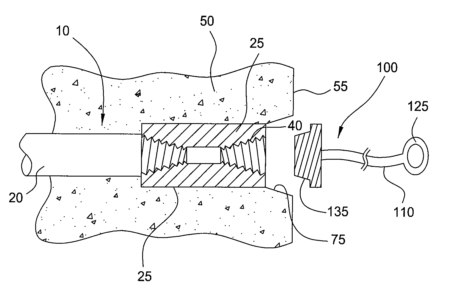 Protective cap for coupler bar