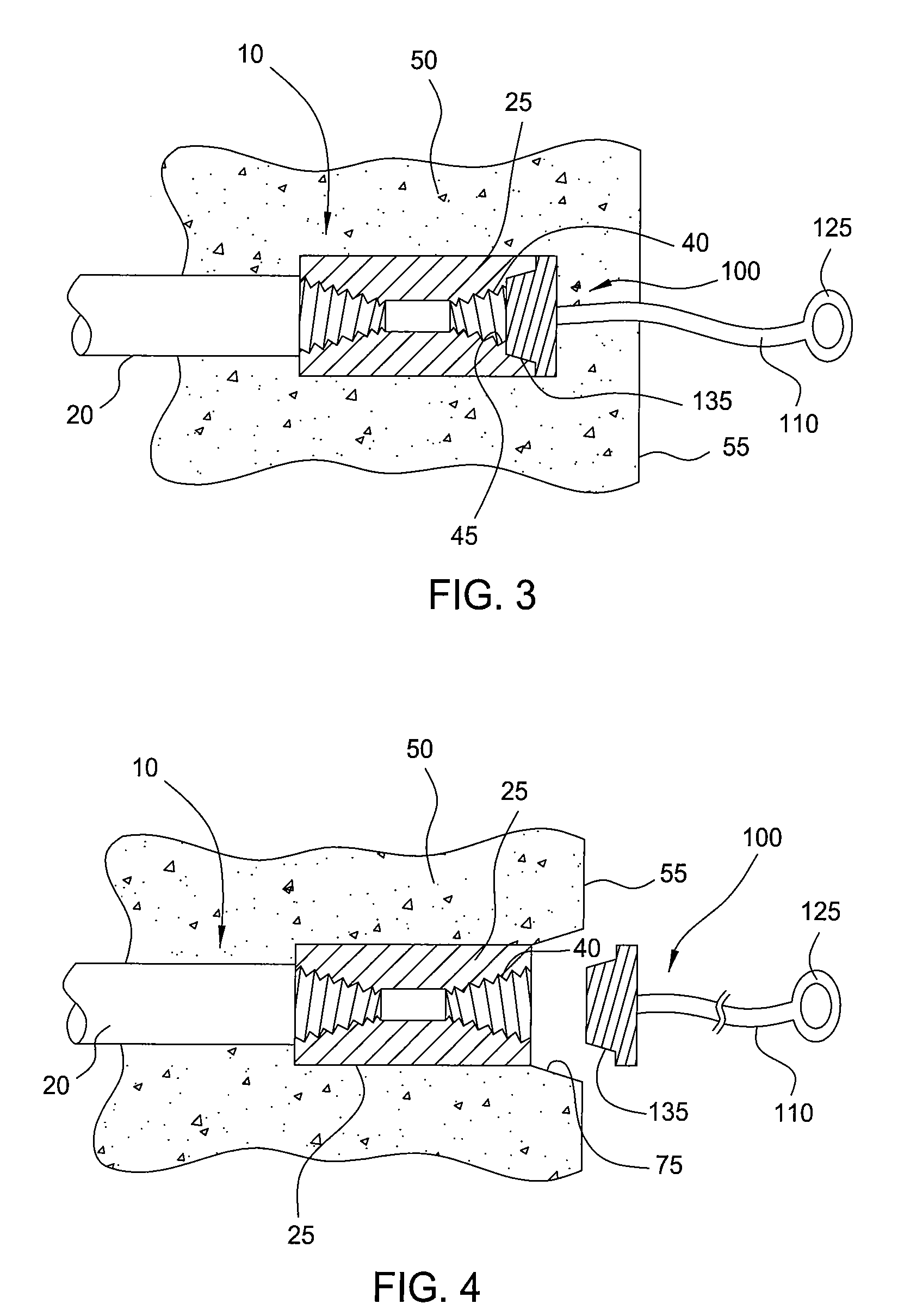 Protective cap for coupler bar