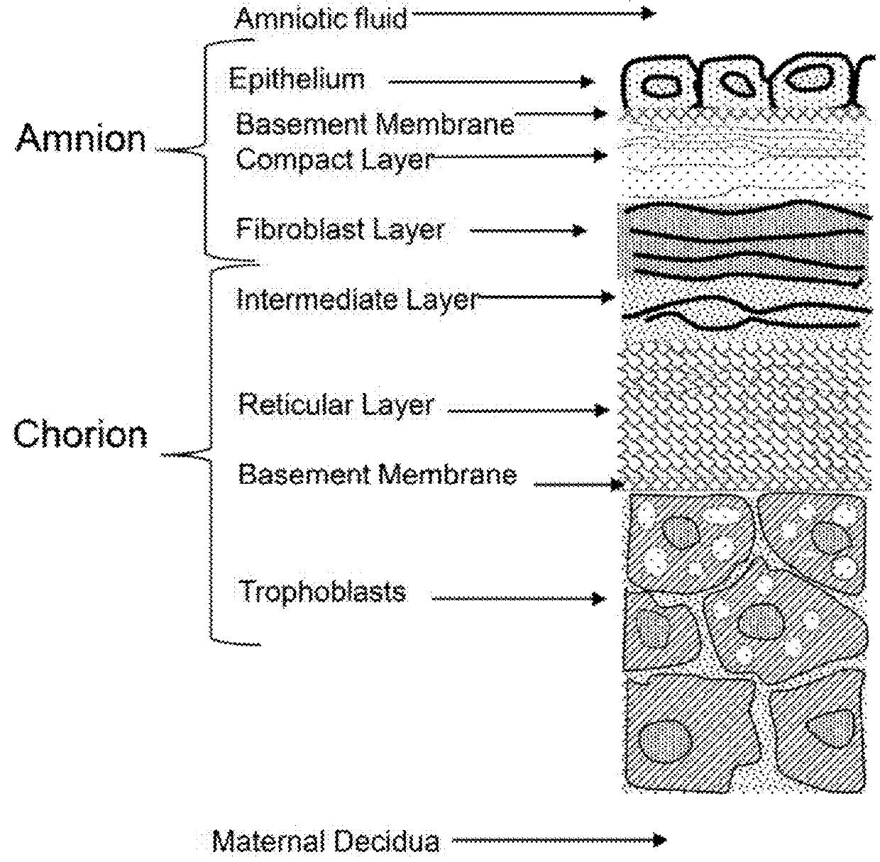 Amnion derived therapeutic composition and process of making same