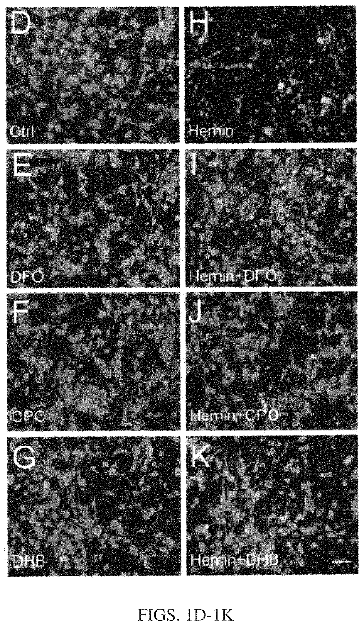 Prolylhydroxylase/ATF4 inhibitors and methods of use for treating neural cell injury or death and conditions resulting therefrom