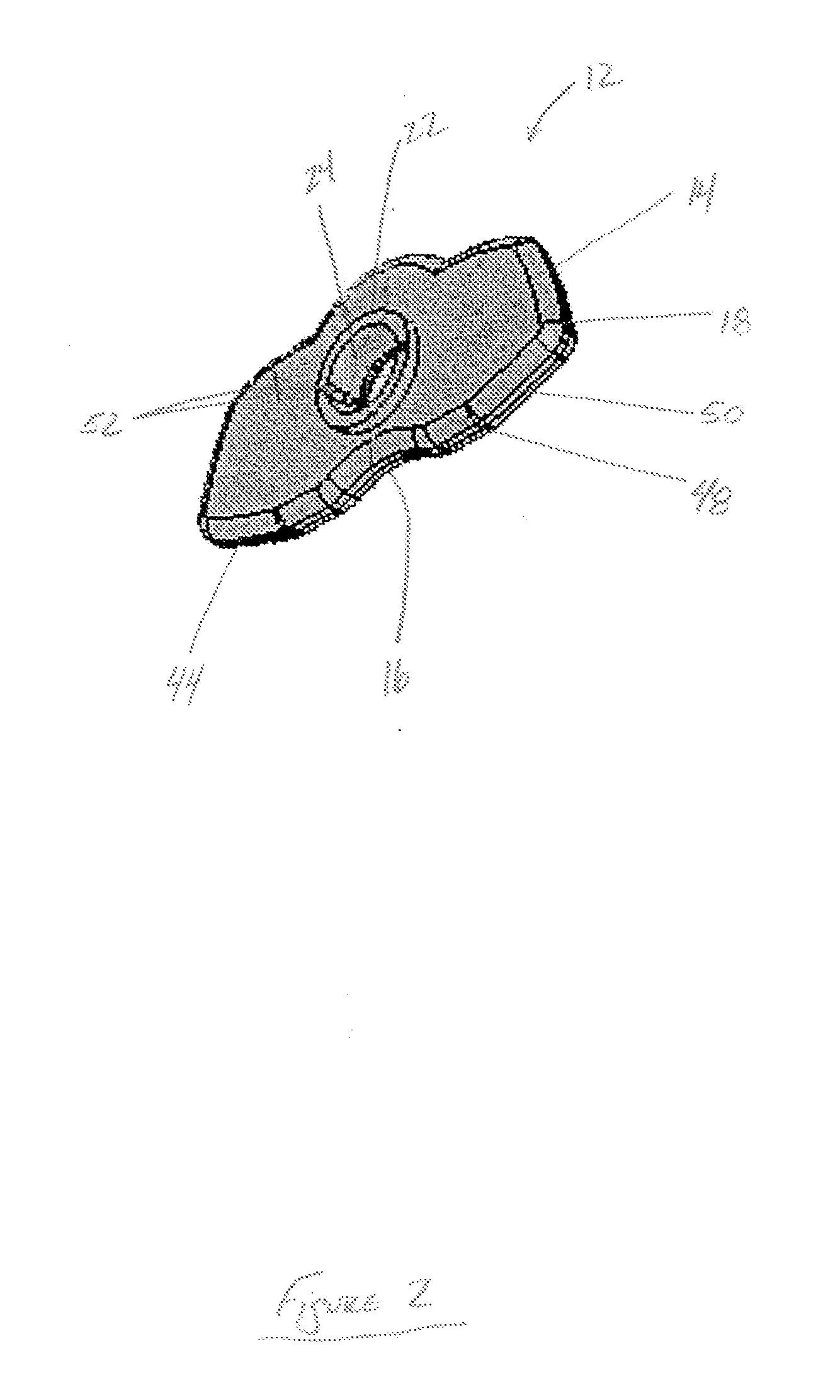 Occlusal device and method of use thereof for diagnostic evaluation of maxillomandibular relationships in edentulous patients
