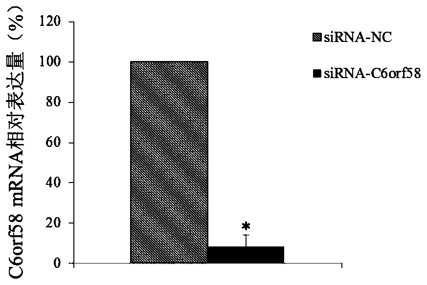 Application of c6orf58 gene in preparation of diagnosis and treatment products for tongue squamous cell carcinoma