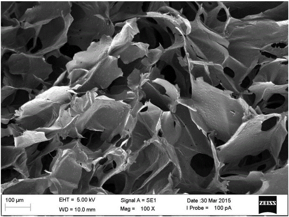 Povidone-iodine gynecological medical sponge and preparation method thereof