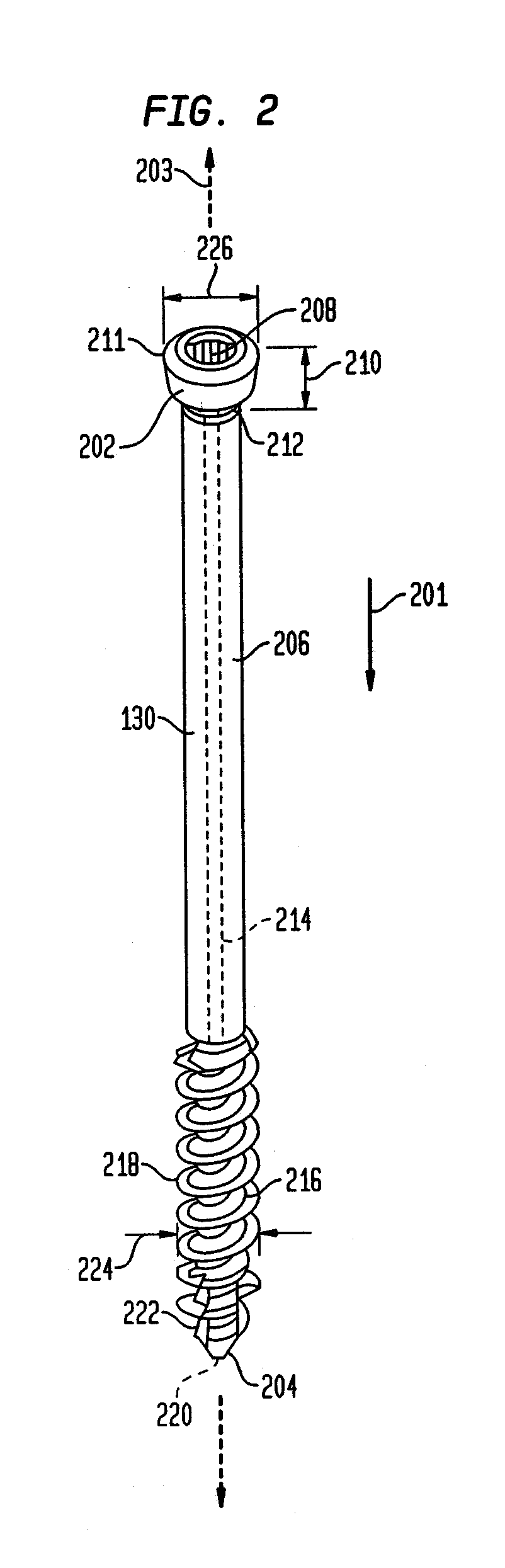 Intramedullary Fixation Assembly and Method of Use
