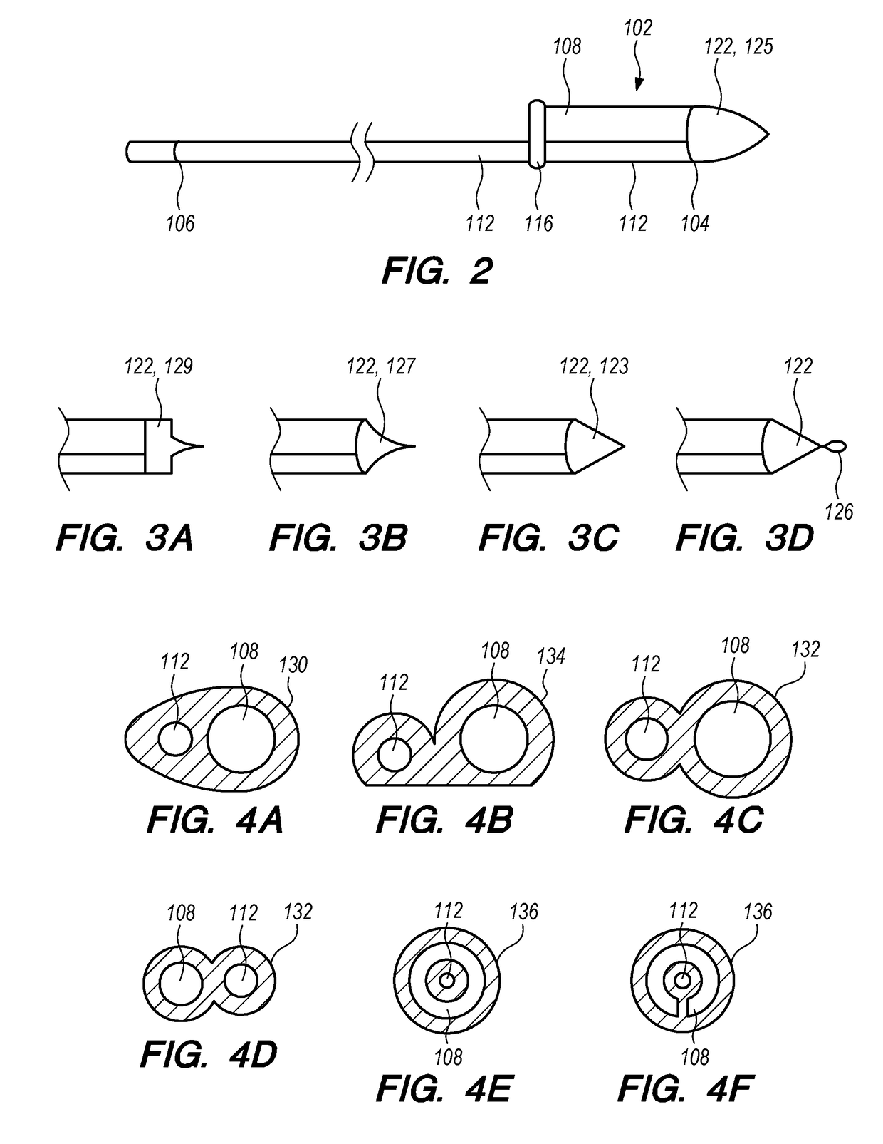 Double Lumen Integrated Enteral Feeding Assembly and a Method for Use Thereof