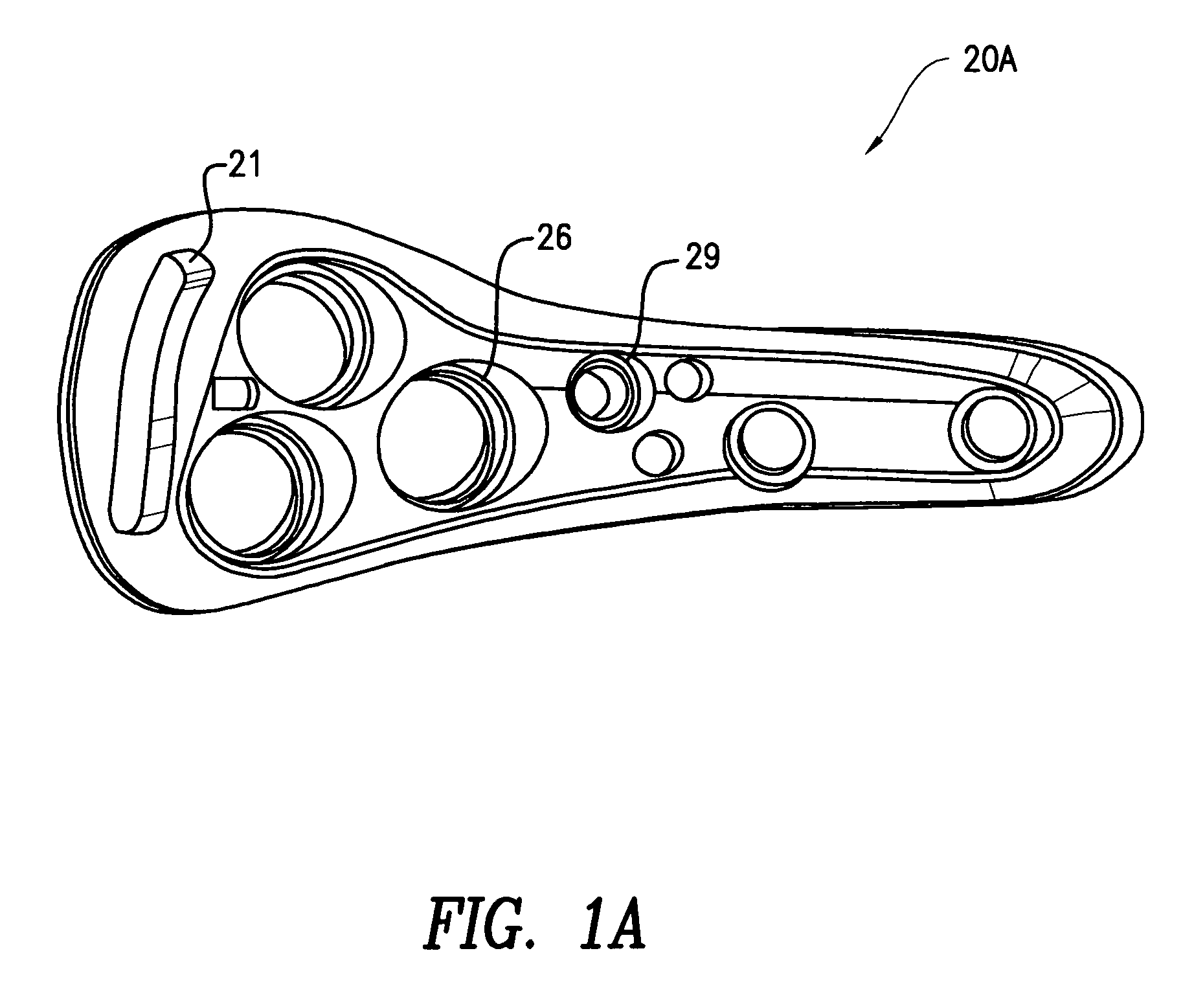 Hip fracture device with static locking mechanism allowing compression