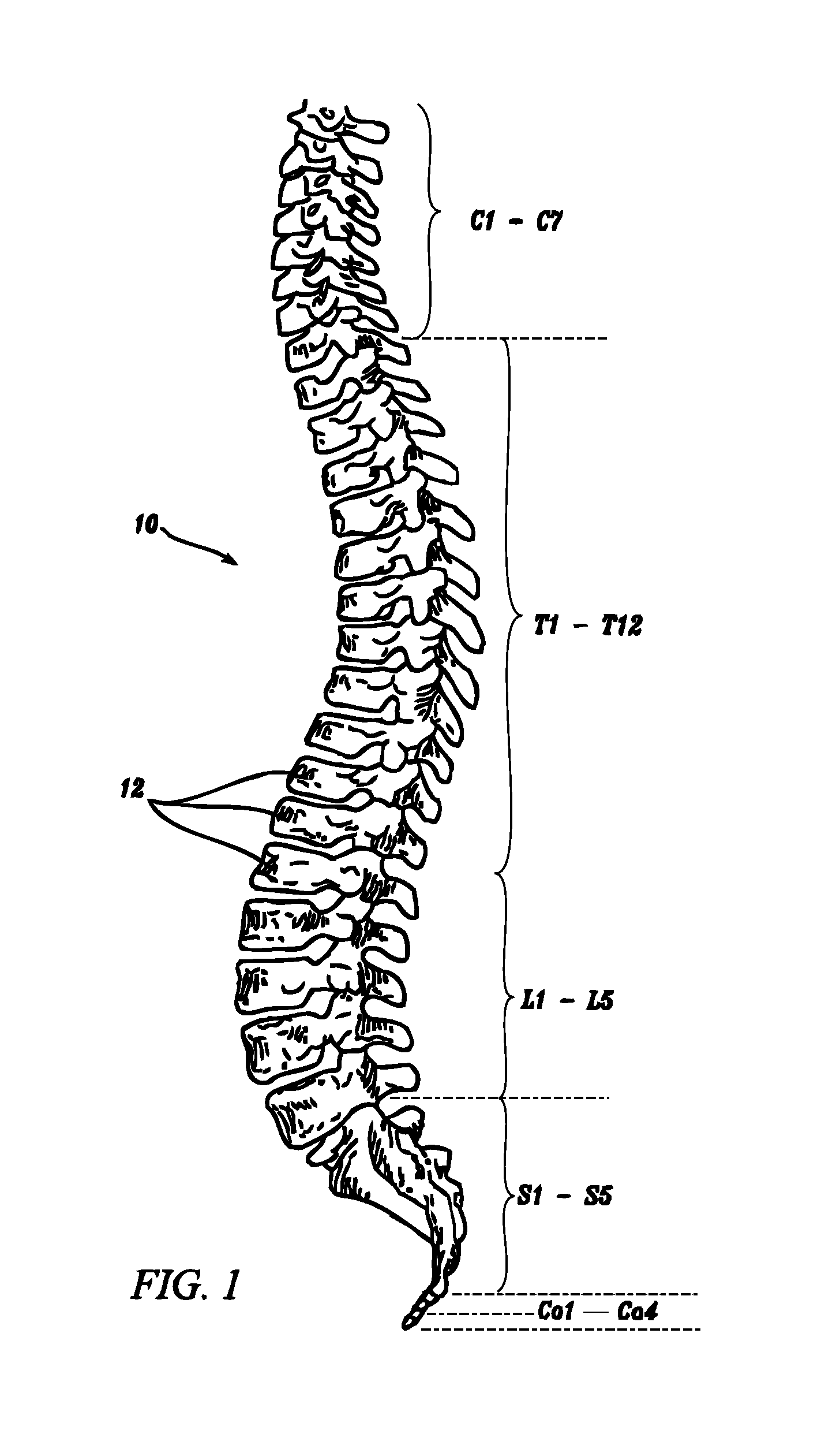 Anti-rotation fixation element for spinal prostheses
