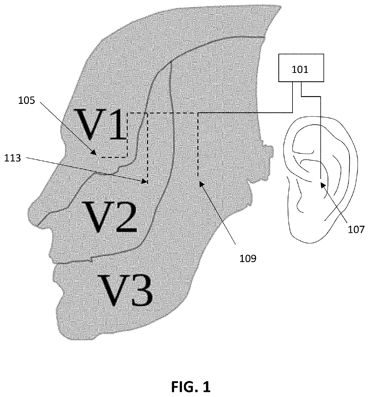 Methods and apparatuses for reducing bleeding via coordinated trigeminal and vagal nerve stimulation