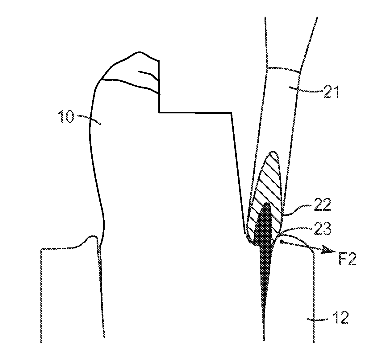 Dental Retraction Composition, Method of Production and Use Thereof