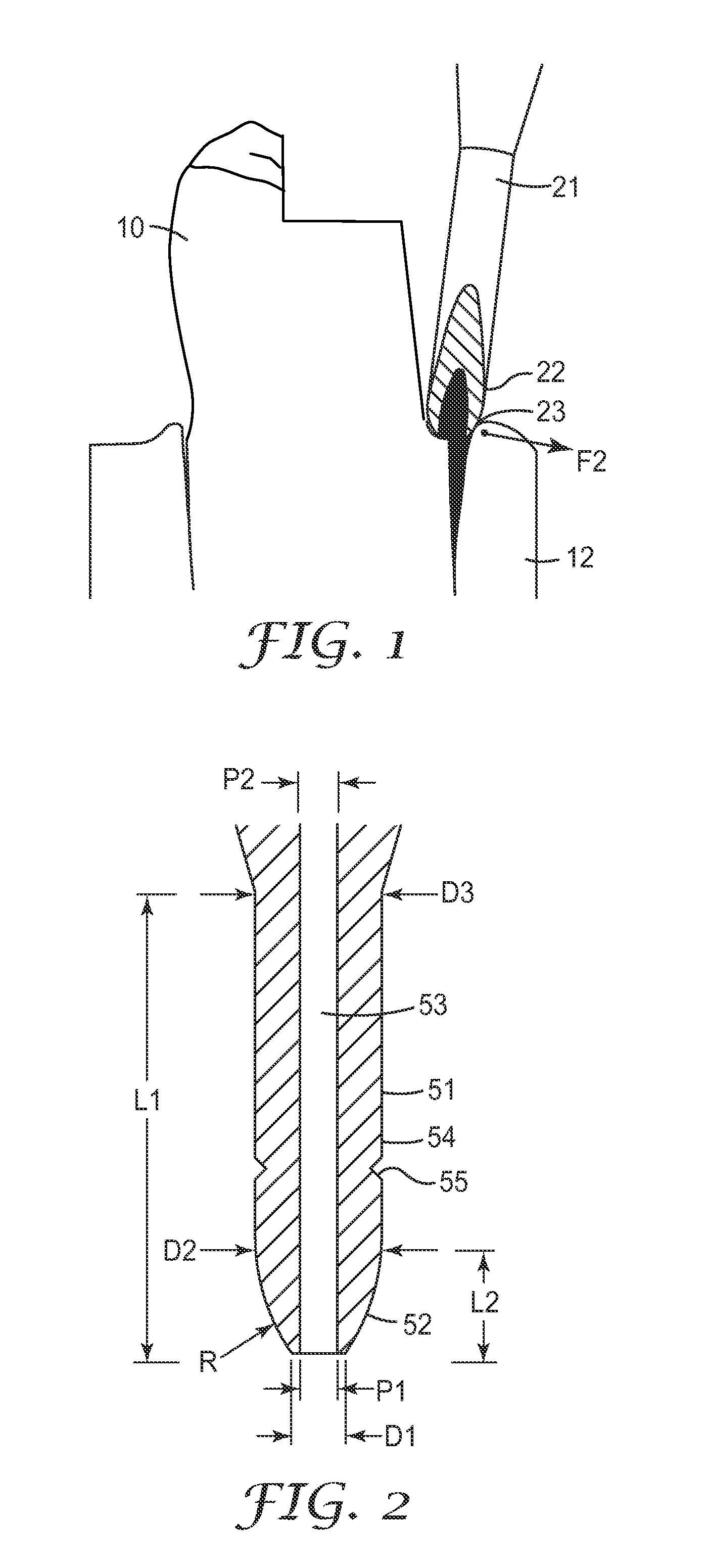 Dental Retraction Composition, Method of Production and Use Thereof