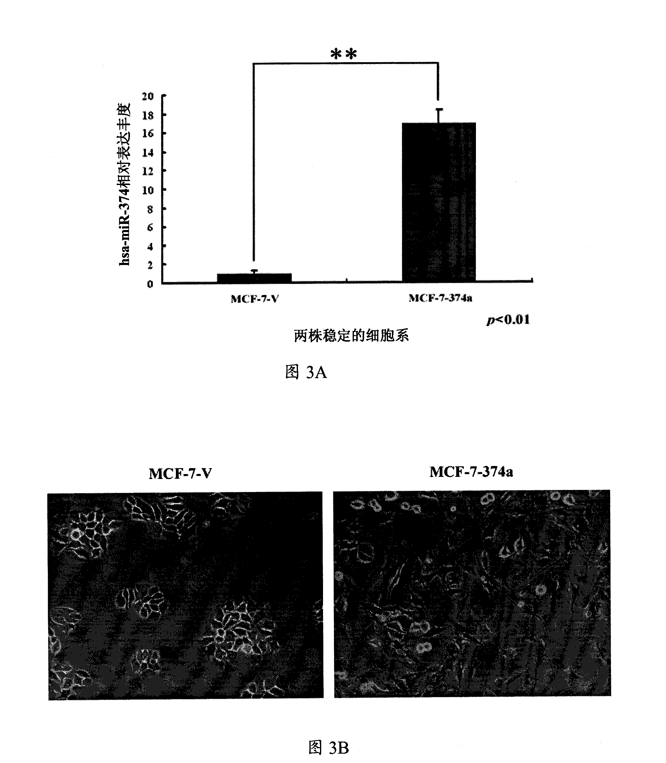 Molecular marker hsa-miR-374a of breast carcinoma and application thereof
