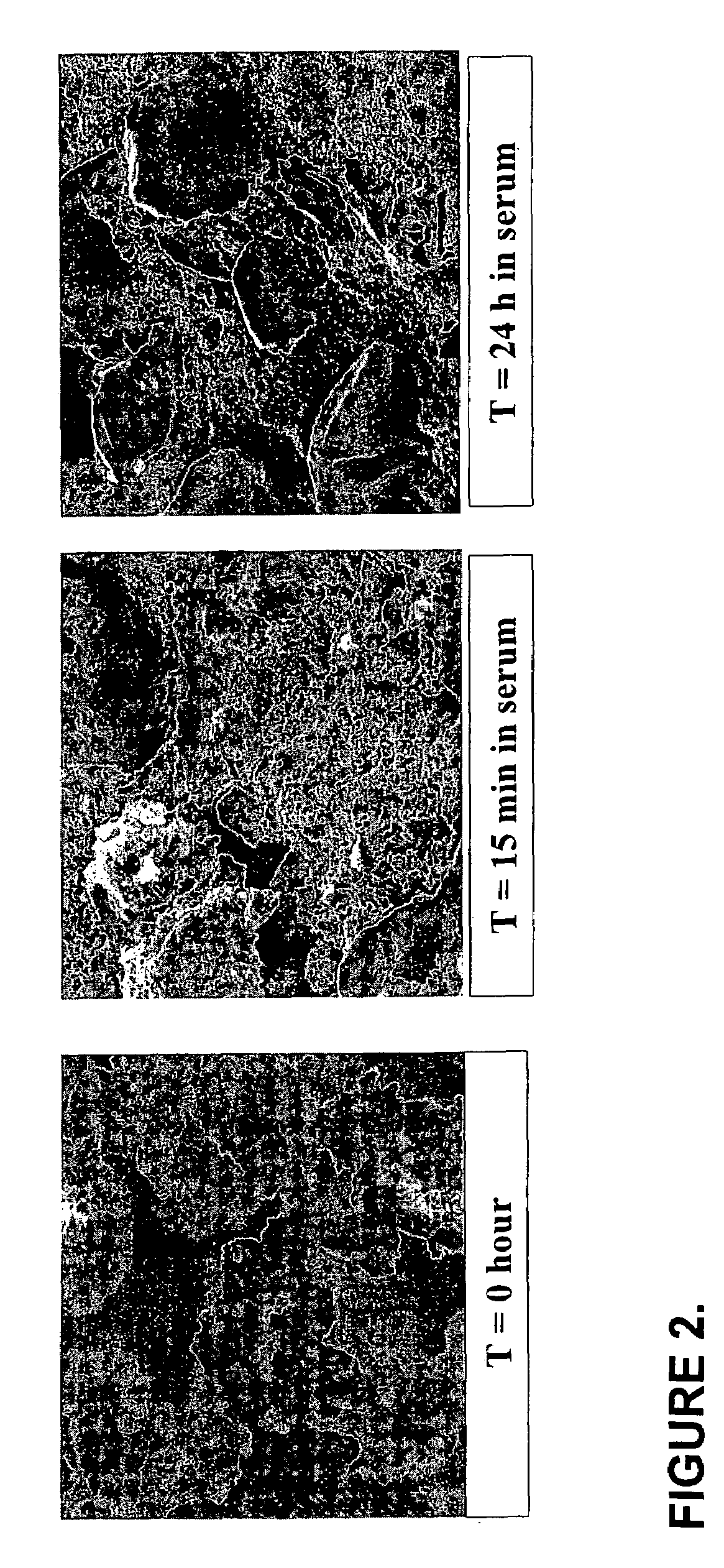 Biocompatible cement containing reactive calcium phosphate nanoparticles and methods for making and using cement