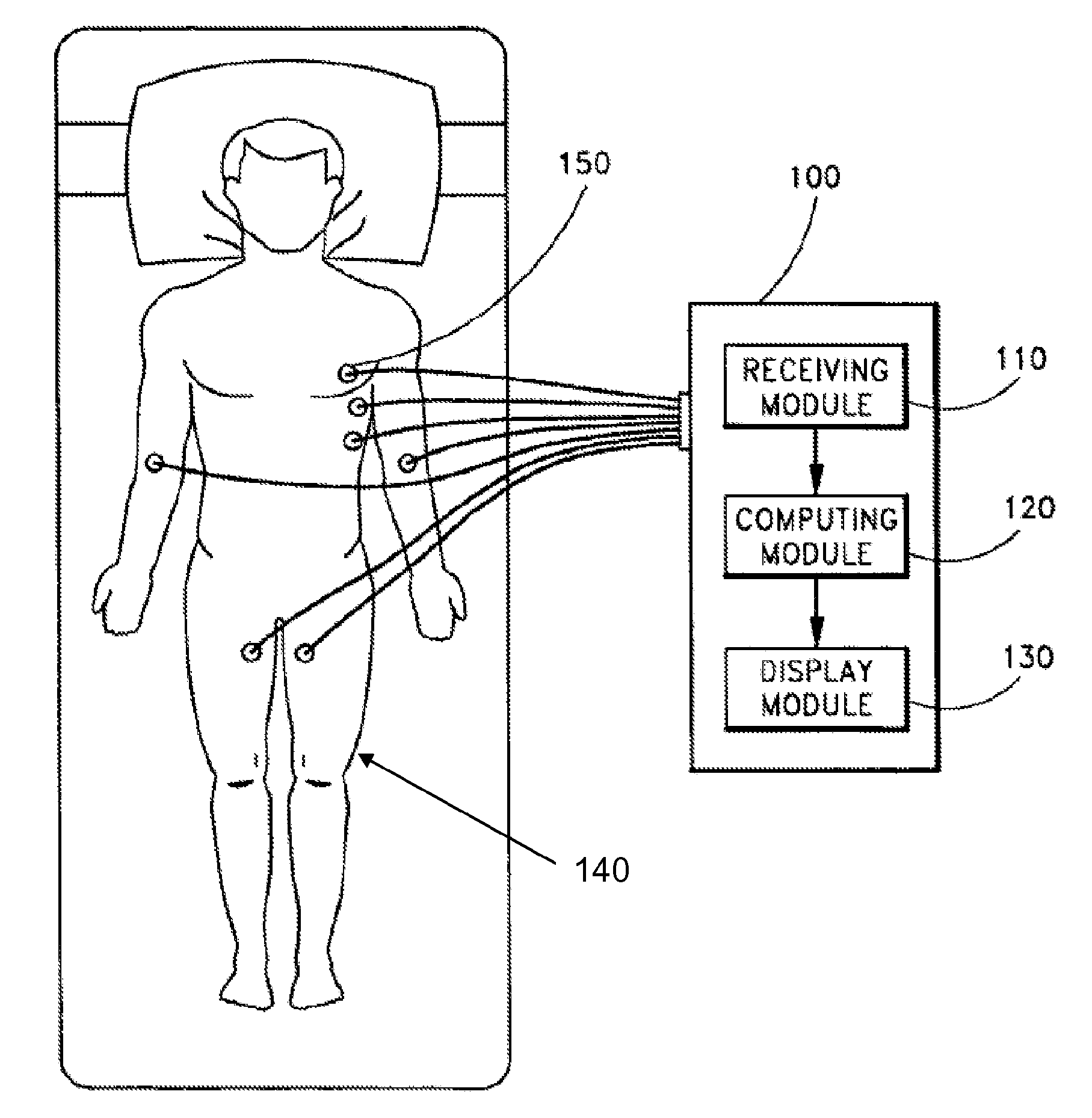System and method for separating cardiac signals
