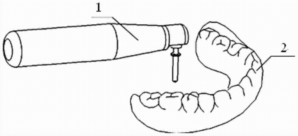 Dental implant surgery guide plate for complete tooth loss and manufacturing method thereof