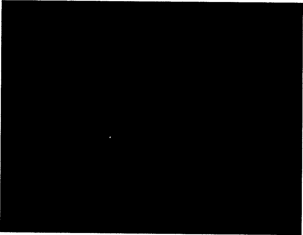 Bone marrow interstital stem cell preparation and its combined use with controlled release neurotrophic factor