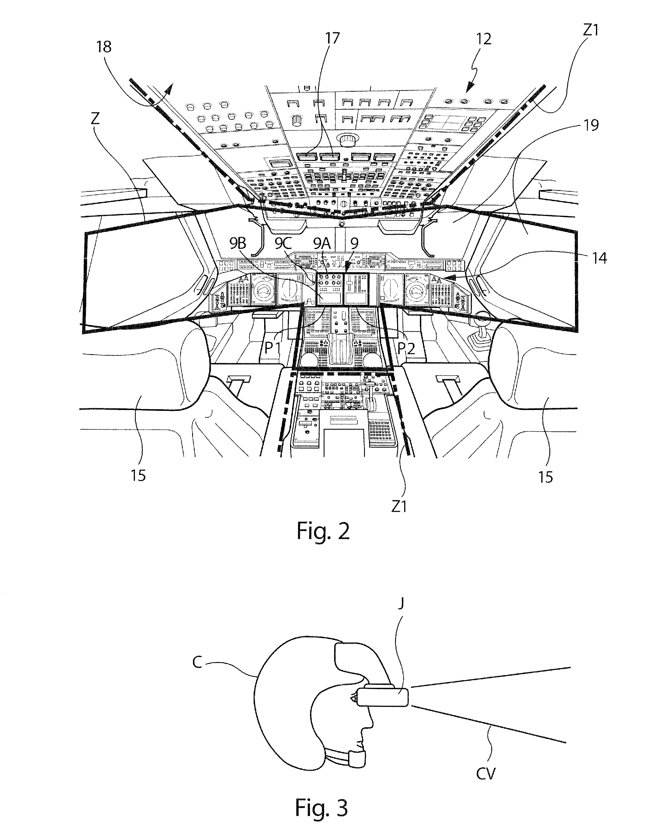 Installation for detecting and displaying the failures of the functional systems of an aircraft
