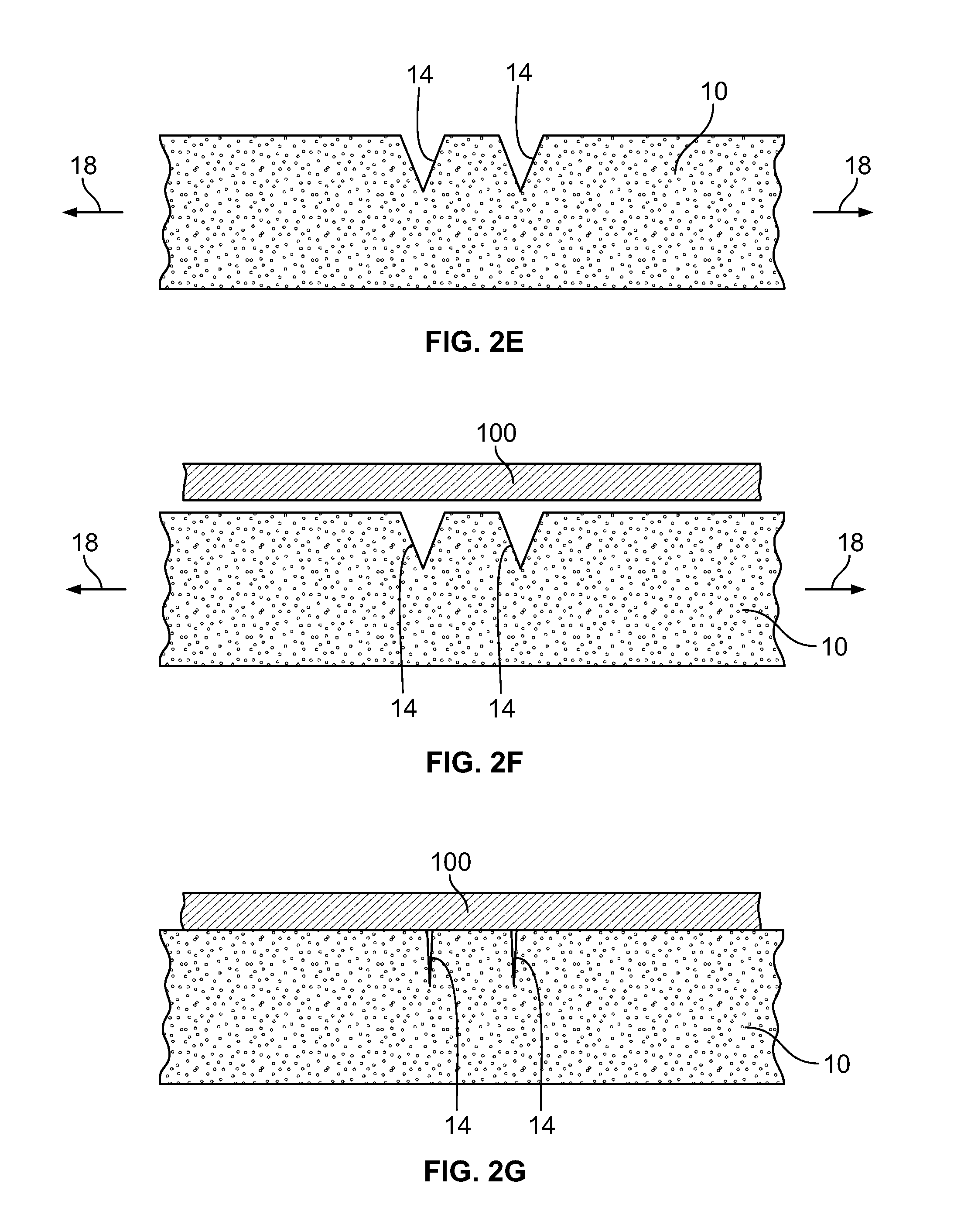 Devices and methods for skin tightening