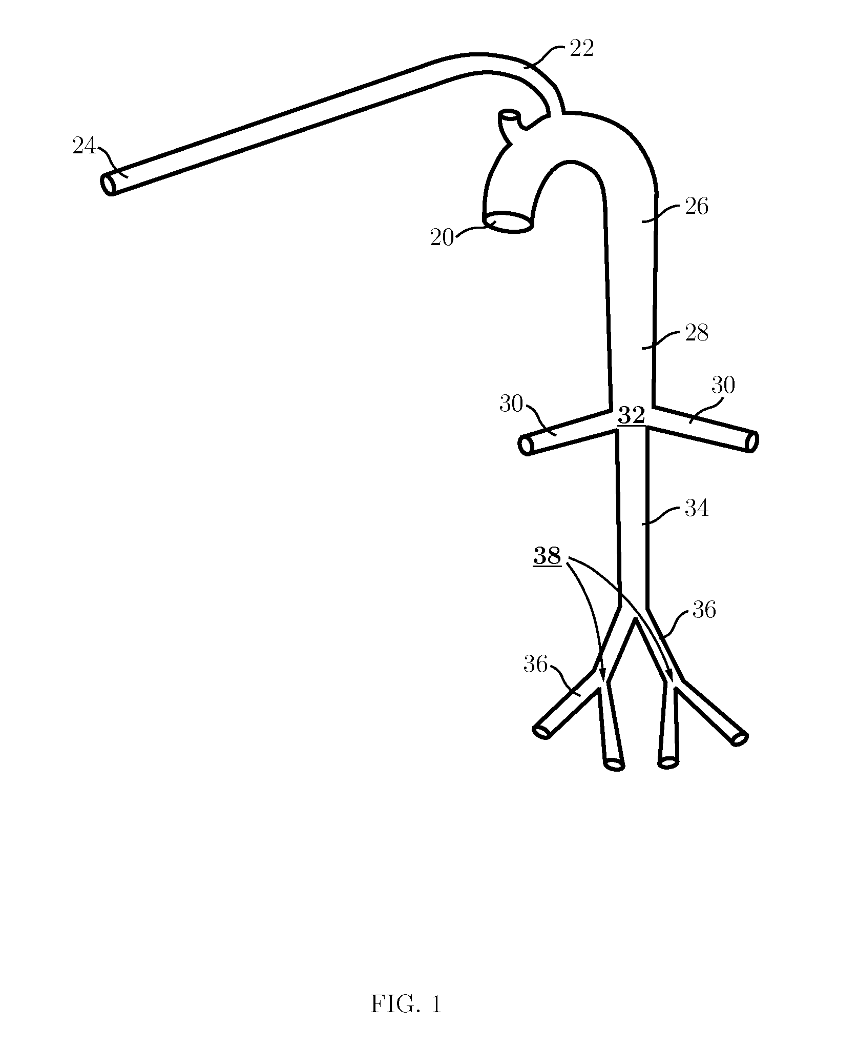 Method of determining stiffness index of an arterial network and System thereof