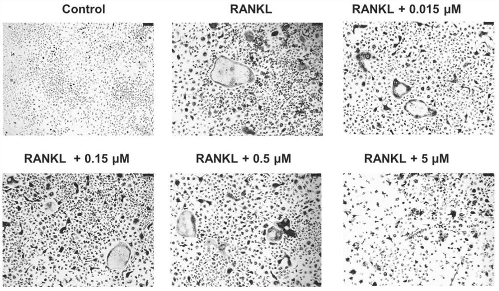 Application of pregnane derivative in preparation of osteoclast differentiation inhibitor