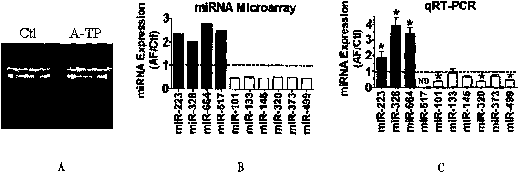 MicroRNA-328 and application of antisense nucleotide thereof for diagnosing, preventing and curing heart diseases
