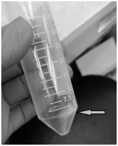 bac clone dna extraction method