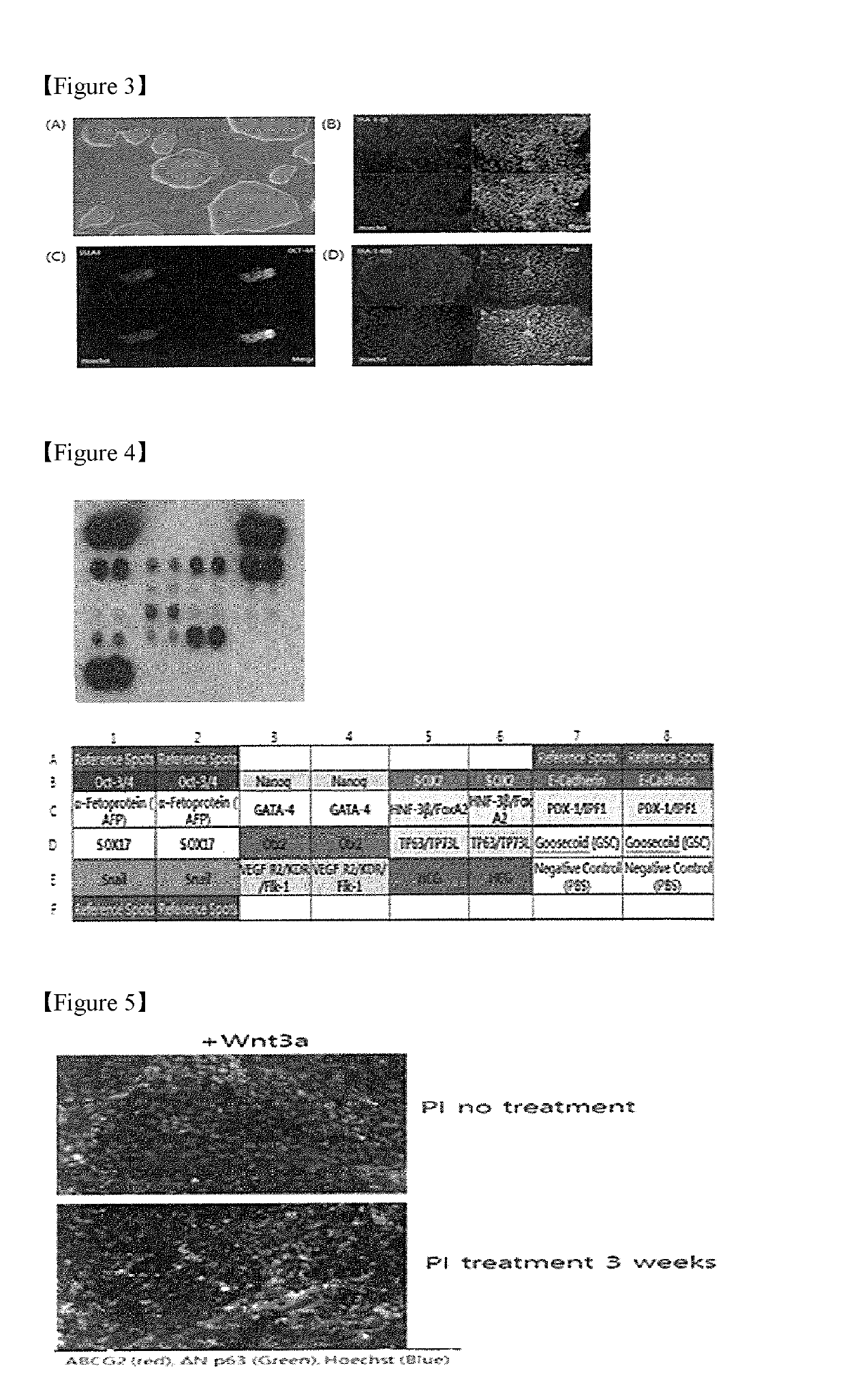 Method and system for culturing corneal stem cell-like cell line by inducing differentiation of induced pluripotent stem cell using protein ligand