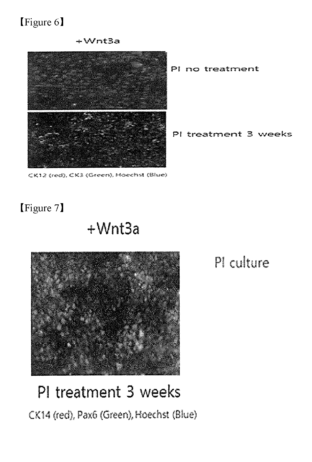 Method and system for culturing corneal stem cell-like cell line by inducing differentiation of induced pluripotent stem cell using protein ligand