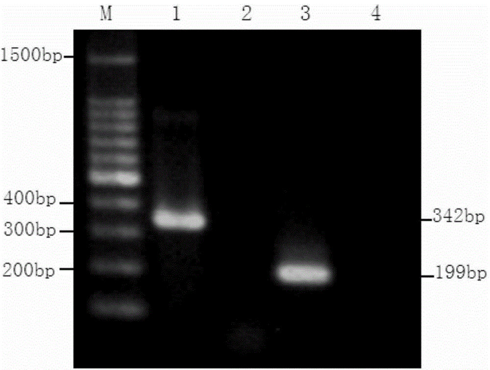 Reagent kit for detecting H4 subtype avian influenza virus based on nested RT-PCR