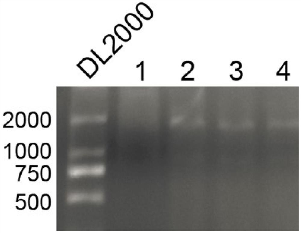 Marker linc01977 and its application