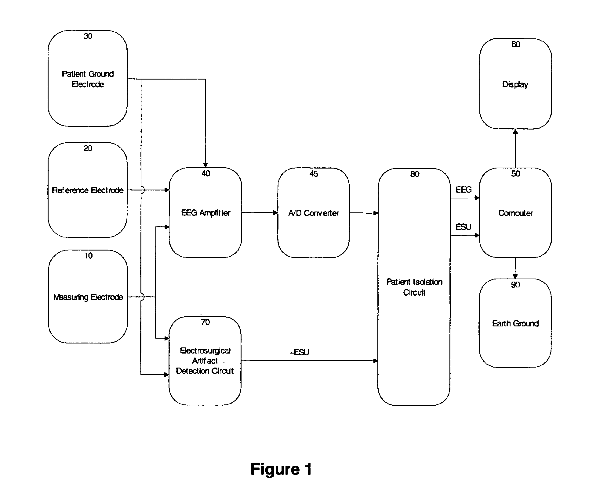 System and method for the detection and removal of radio frequency noise artifact from biopotential signals